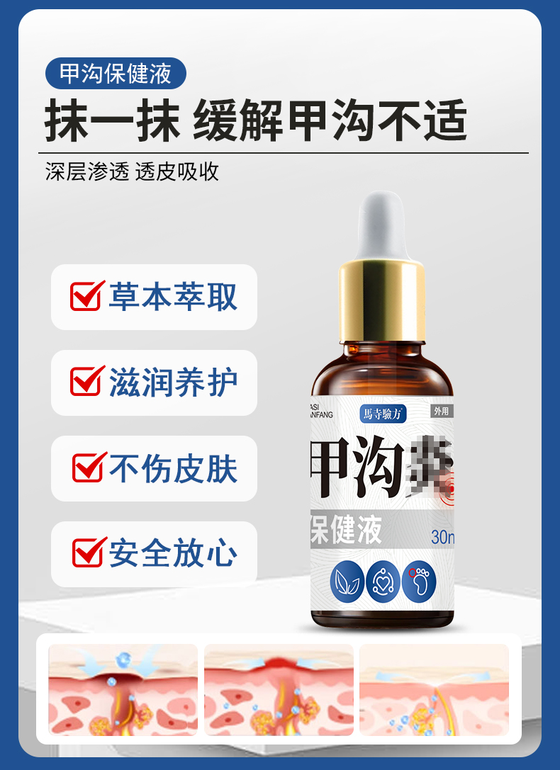 抹一抹，緩解甲溝不適